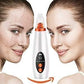 Remove Blackhead Device